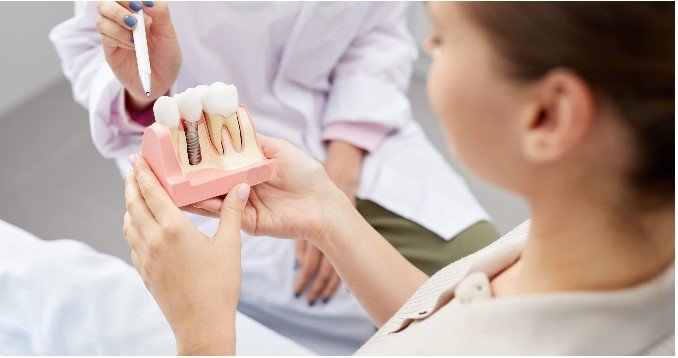 Dental Implant 1