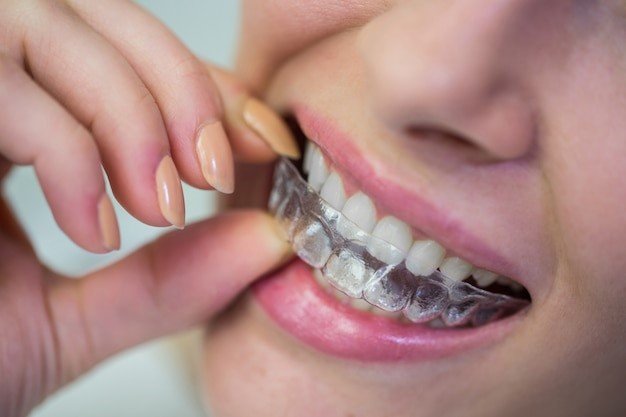 Orthodontics