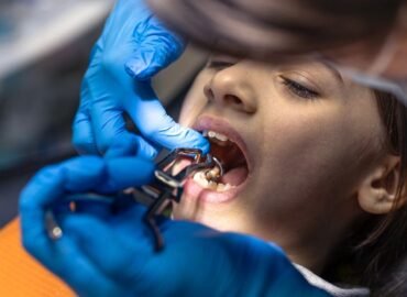 Missing a Tooth A Dental Bridge Could Be Your Perfect Fix! Missing-a-Tooth-A-Dental-Bridge-Could-Be-Your-Perfect-Fix